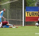 Kopeme za Bertíka: FK Olešník - Sparta legends